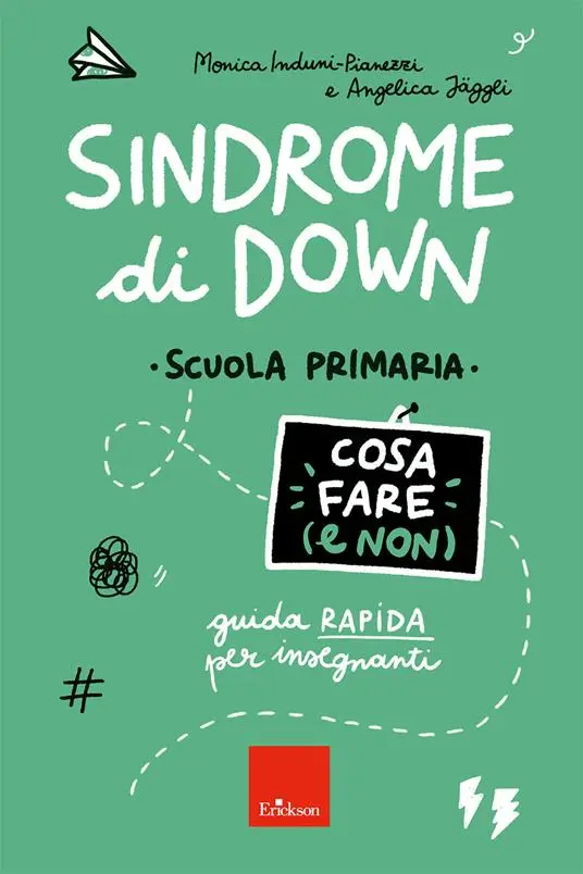 Sindrome di Down